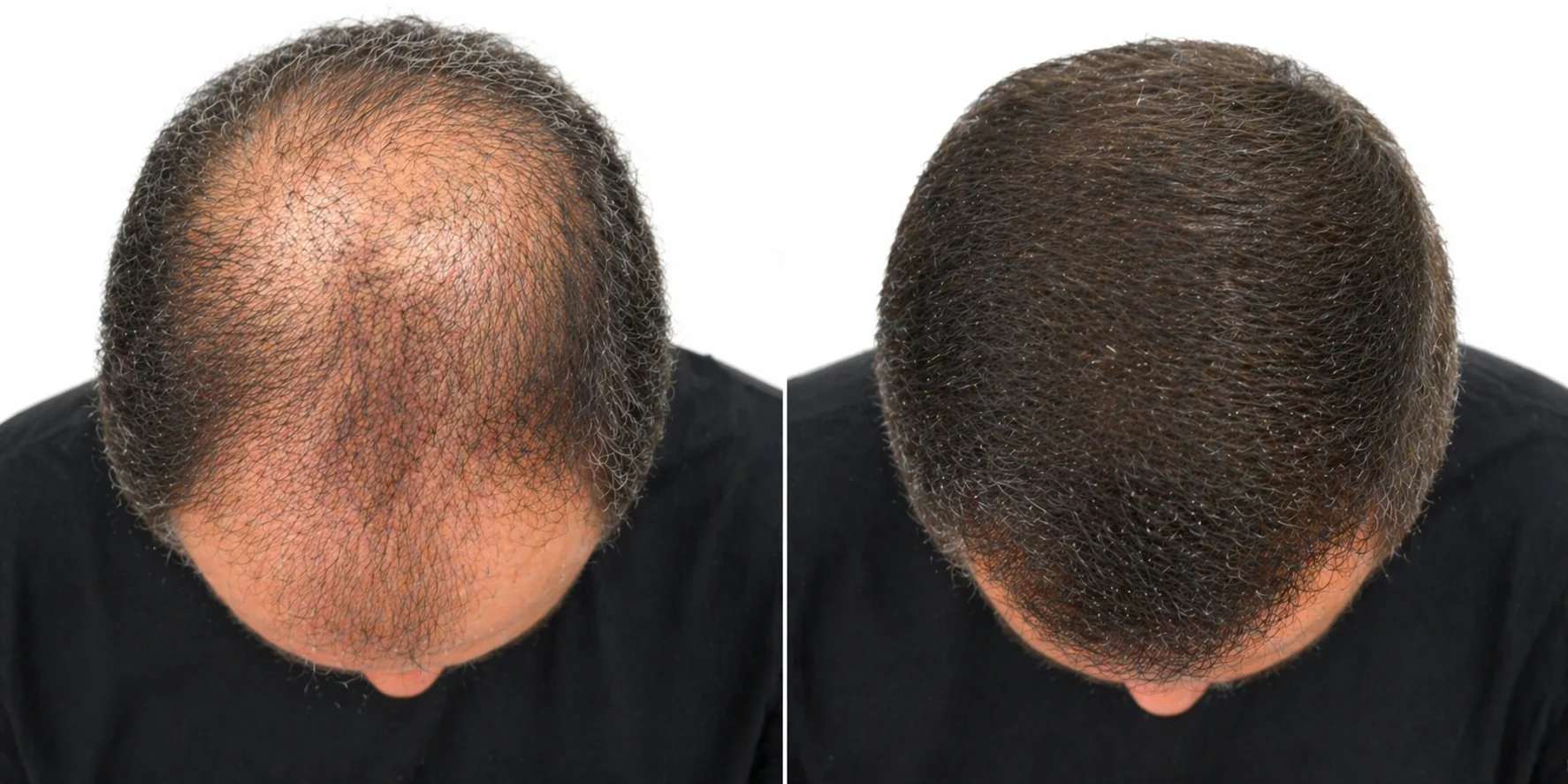 Antes e depois
